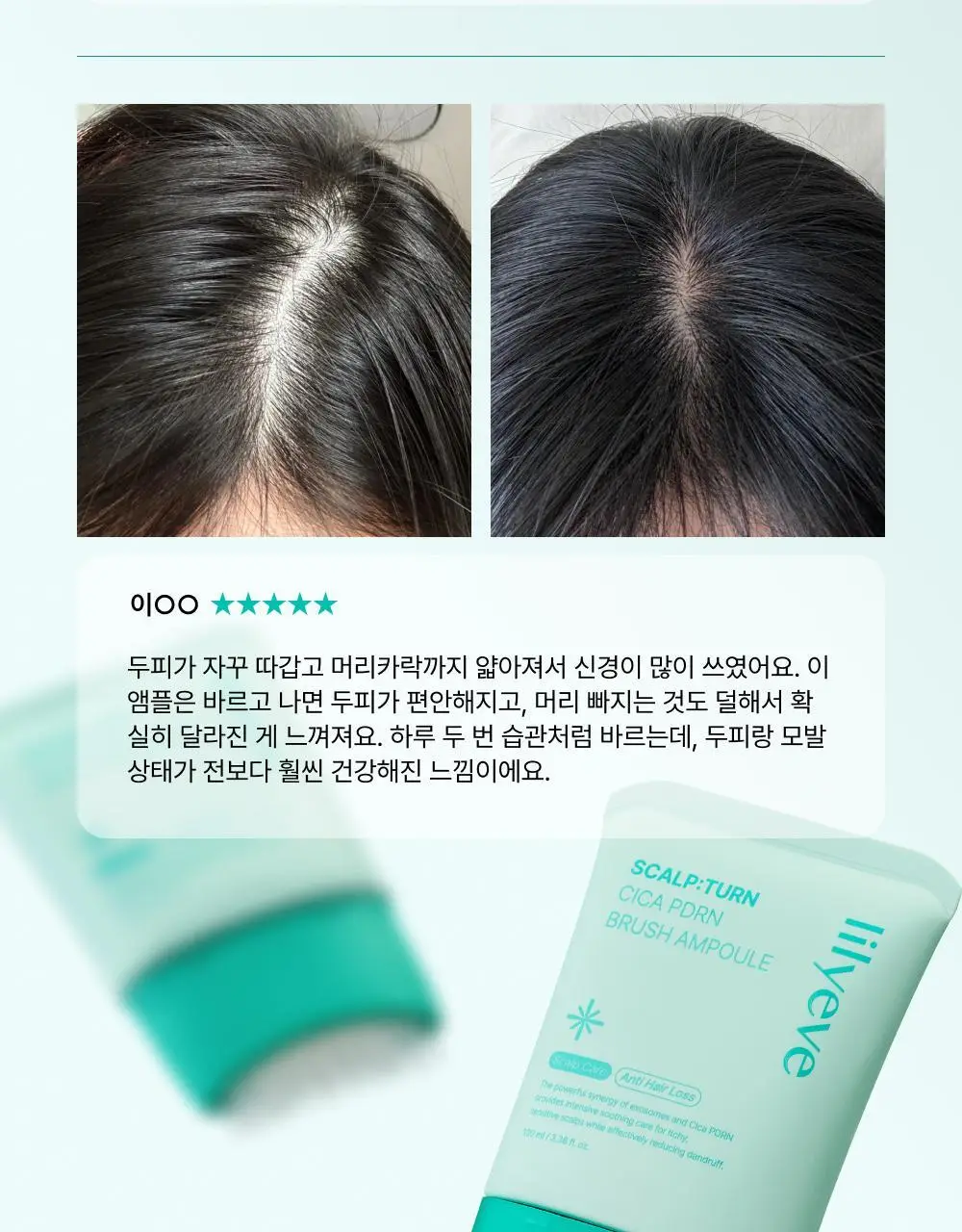 [포켓몬 에디션][비듬/각질케어]릴리이브 스칼프턴 시카 PDRN 브러쉬 앰플 100ml 2종 택1 상세페이지 36